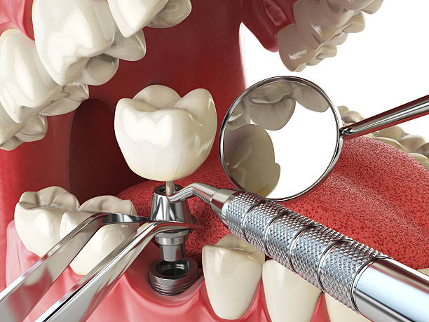 Best Emergency Gum Pain Relief  in Tri City, OR