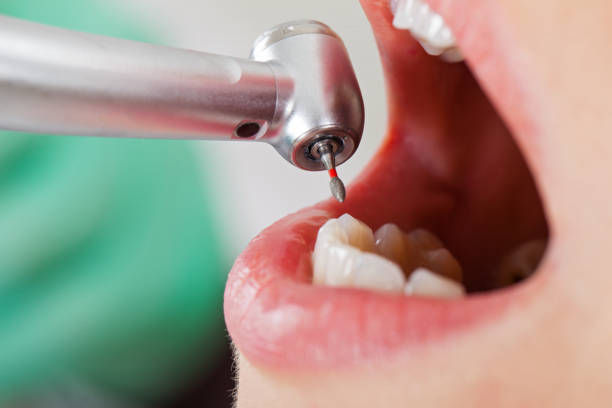 Best Dentist Open Late Near Me  in Tri City, OR